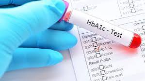 A1C to average blood glucose conversion chart — table showing HbA1c percentage alongside estimated average glucose in mg/dL for diabetes management