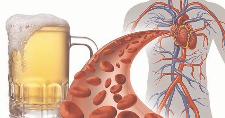 alcohol standard drinks sizes AF holiday heart blood pressure effect AHA WHO Canada 2023 guidelines weekly limits