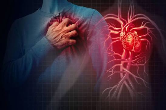 Angina chest pain diagram showing reduced blood flow through narrowed coronary artery causing myocardial ischemia