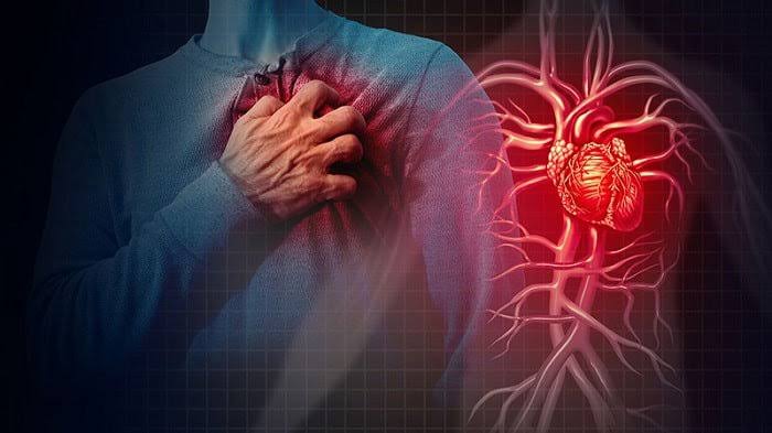 aspirin primary prevention 2018 trials ASPREE ARRIVE ASCEND bleeding risk benefit ACC AHA 2022 guidelines