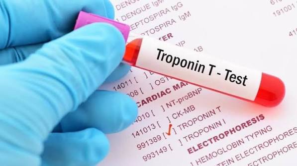 Blood tests for heart health laboratory results LDL HDL triglycerides cholesterol interpretation cardiovascular risk normal ranges