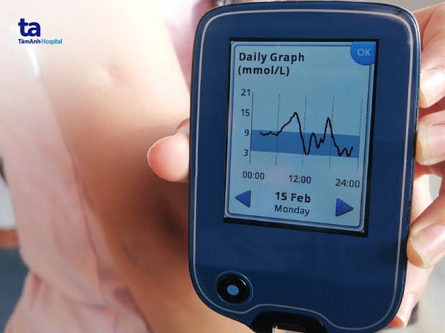 CGM glucose graph showing time in range overnight trends and glucose variability data for diabetes management optimization