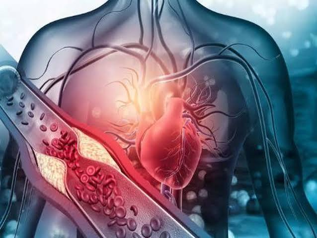 Cardiovascular risk calculation — factors used to estimate 10-year heart attack risk including cholesterol levels