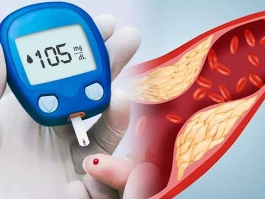 cholesterol monitoring diabetes — blood lipid panel test tube with cholesterol level results showing LDL HDL and triglycerides for cardiovascular risk management in diabetes