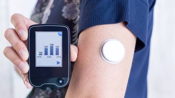 Continuous glucose monitoring CGM sensor worn on arm showing real-time glucose graph and trend arrows for diabetes management