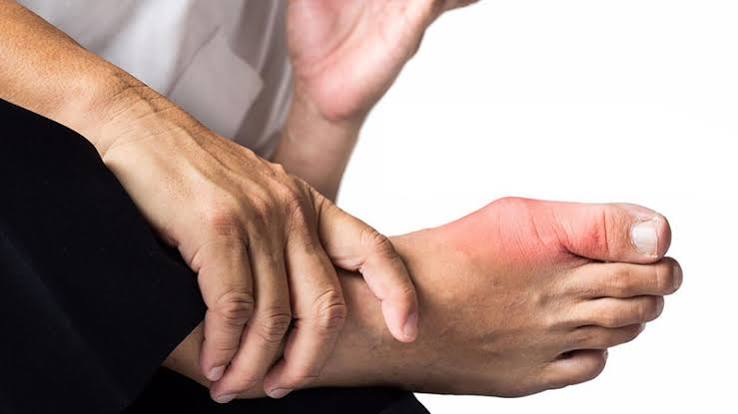 diagram showing peripheral nerve damage in the feet and lower legs caused by diabetic peripheral neuropathy