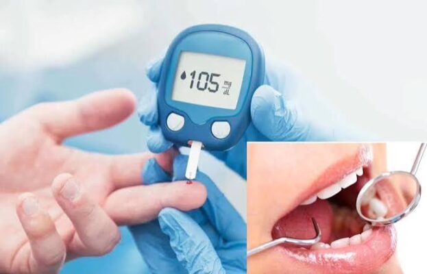 dentist examining the gums of a patient with diabetes showing signs of periodontal disease caused by elevated blood sugar