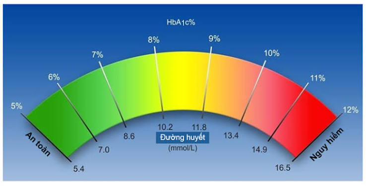 diabetes hunger mechanism showing insulin resistance and hyperinsulinemia driving blood sugar and appetite dysregulation