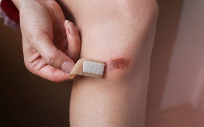 diabetic foot wound care and inspection preventing ulcer development in people with diabetes