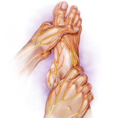 diabetic neuropathy symptoms — feet showing numbness tingling and burning pain from peripheral nerve damage in adults with long-term diabetes