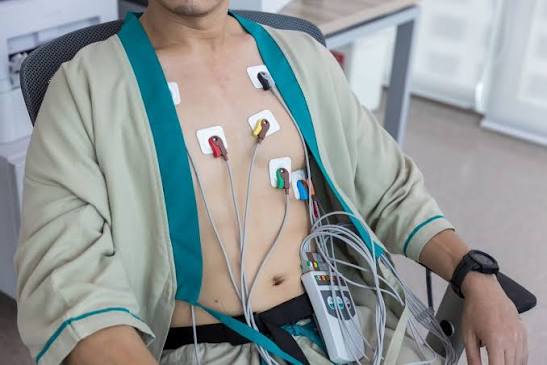 Event monitor irregular heartbeats cardiac event recorder palpitations arrhythmia detection atrial fibrillation remote ECG transmission