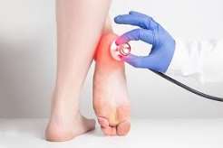 Foot exams for people with diabetes — doctor performing monofilament nerve sensation test on diabetic patient foot during annual diabetes foot examination