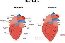Heart failure patient monitoring daily weight on scale for fluid retention tracking