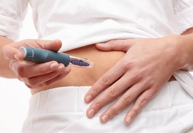 insulin injection technique — proper subcutaneous injection site on abdomen for diabetes insulin therapy