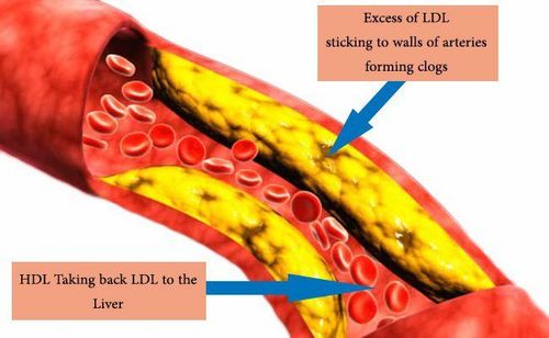 Cholesterol balance scale showing LDL and HDL levels — healthy vs unhealthy ratio