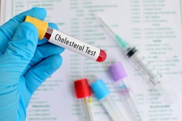 Lipid panel explained LDL HDL triglycerides total cholesterol cardiovascular risk blood test fasting results interpretation