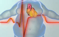 Obesity and heart health — doctor measuring patient waist circumference for cardiovascular risk assessment