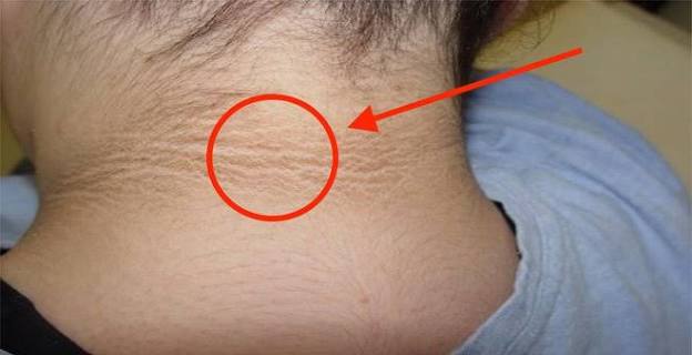 blood glucose meter showing prediabetes range fasting glucose reading between 100 and 125 mg per dL