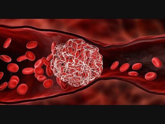 Pulmonary embolism warning signs shortness of breath chest pain rapid heart rate low oxygen saturation hypoxemia emergency