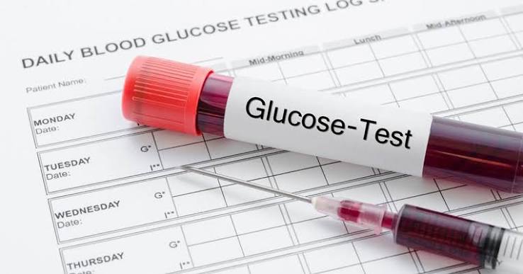 Random blood sugar test showing glucose measurement taken at any time of day without fasting preparation
