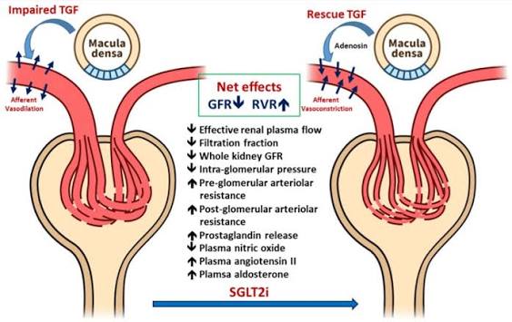 SGLT2 inhibitors for diabetes — medication tablets representing empagliflozin dapagliflozin canagliflozin drug class