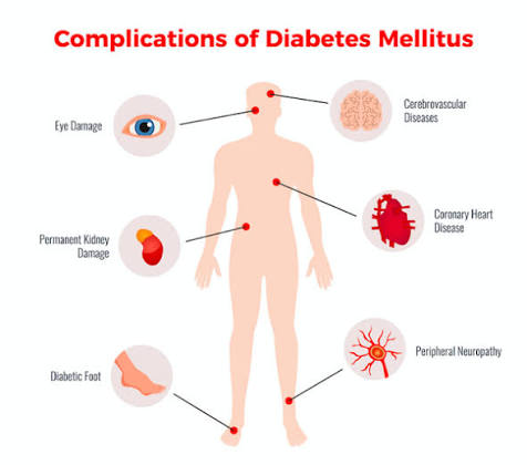 sick day diabetes management showing blood sugar monitoring insulin adjustment fluid intake and ketone checking protocol during illness