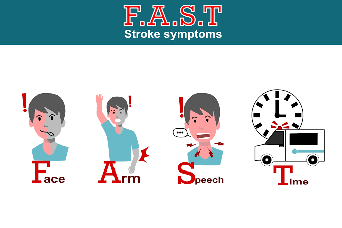 Stroke symptoms including sudden severe headache vision loss arm weakness face drooping and speech difficulty