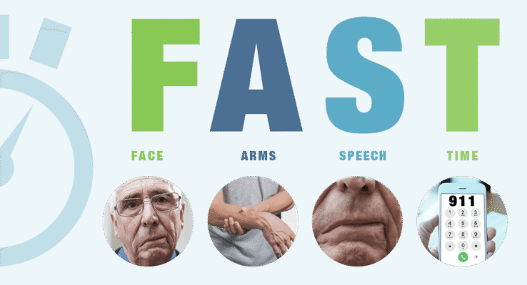 Stroke warning signs FAST acronym showing Face drooping Arm weakness Speech difficulty Time to call 911
