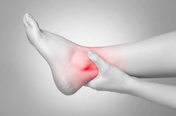 Swollen ankles and circulation problems pitting edema venous insufficiency heart failure kidney disease causes