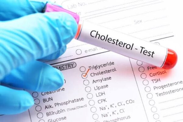 Total cholesterol test results on a lab report with reference ranges shown