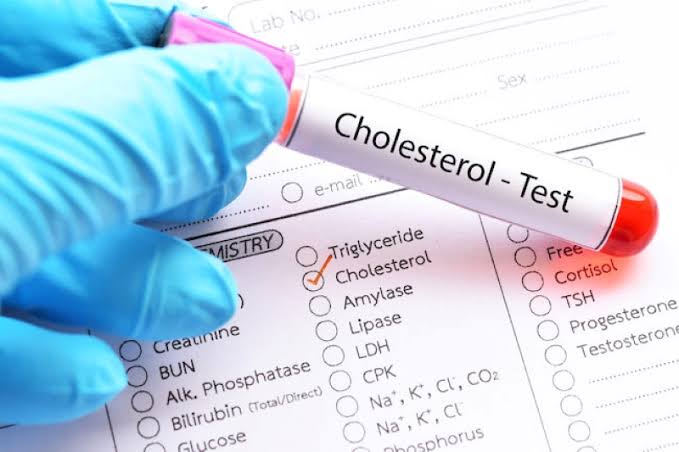 Total cholesterol test results on a lab report with reference ranges shown