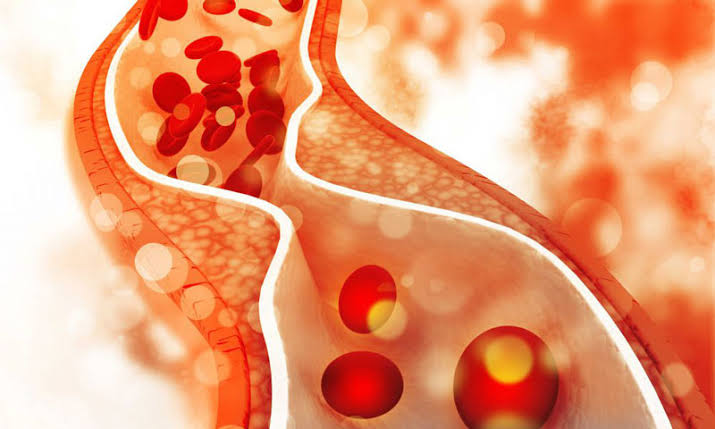 Foods that raise and lower triglycerides — sugar and alcohol raise them, omega-3 and fiber lower them