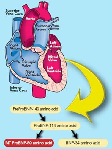 Troponin test serial measurement timeline rise fall pattern chest pain emergency department acute MI heart attack diagnosis