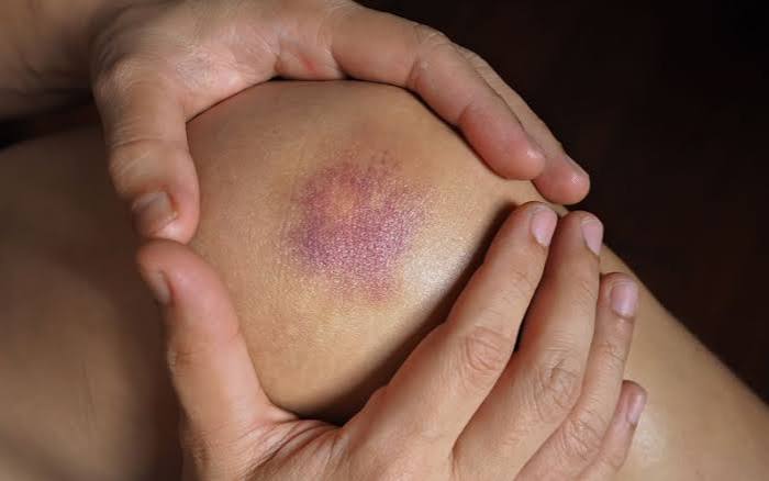 type 2 diabetes symptom progression from subtle early signs to serious complications over years