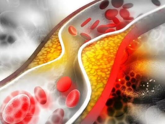 weight and blood pressure obesity hypertension visceral fat sympathetic nervous system insulin resistance