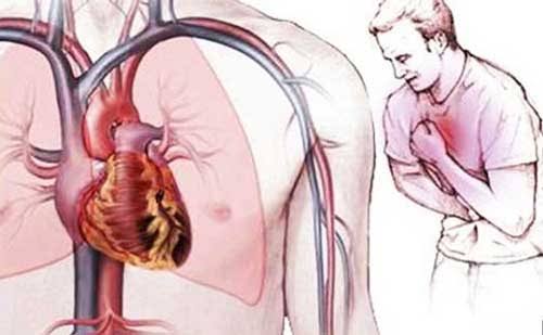 Visual showing major risk factors that cause heart disease including smoking high blood pressure cholesterol and diabetes
