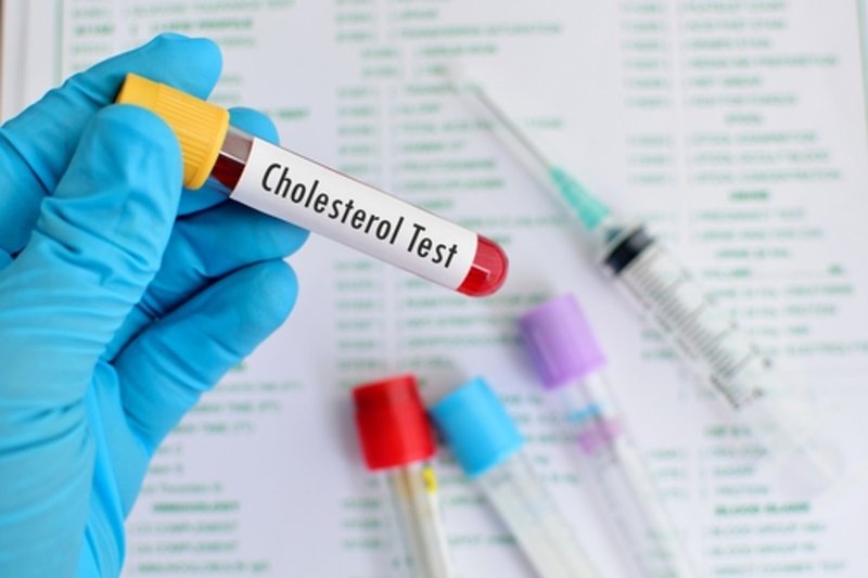 What is a lipid panel — blood test tube for cholesterol measurement