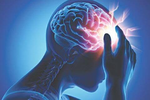What is a stroke showing disrupted brain blood flow causing neuron death and neurological deficits