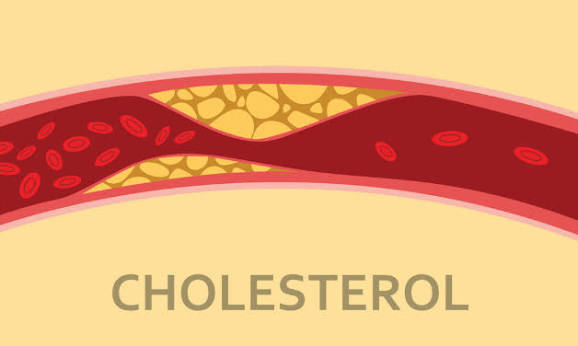 What is cholesterol — illustration of cholesterol molecule and healthy arteries