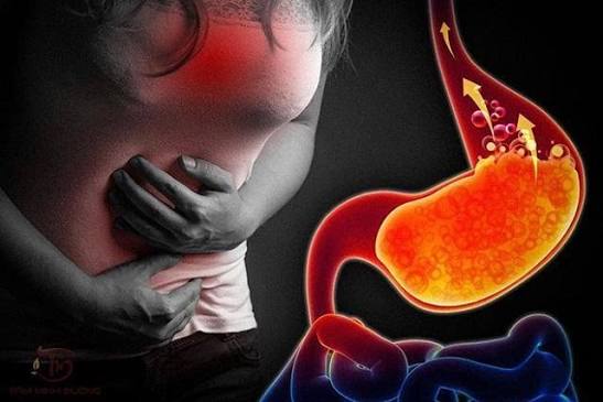 acid-reflux-symptoms-causes-and-prevention-body — LES dysfunction and acid reflux causes including diet, obesity, and hiatal hernia