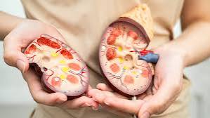 advanced kidney disease dialysis preparation vascular access AV fistula monitoring