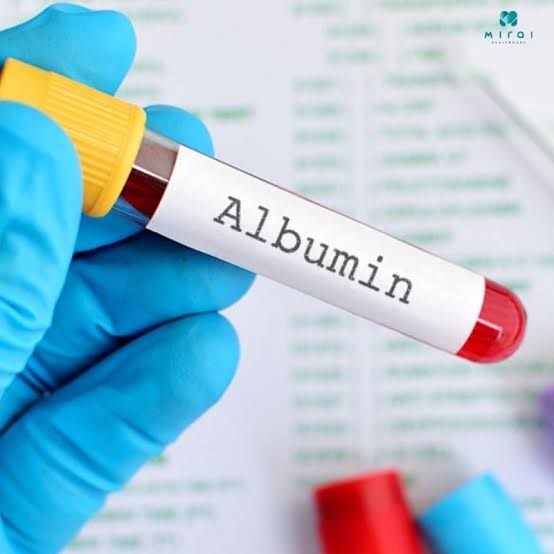 albumin and liver function — low serum albumin chronic liver disease cirrhosis synthetic function
