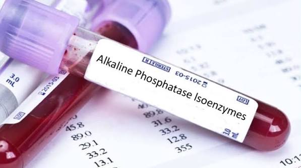 alkaline phosphatase test explained — elevated ALP GGT cholestasis bile duct liver bone