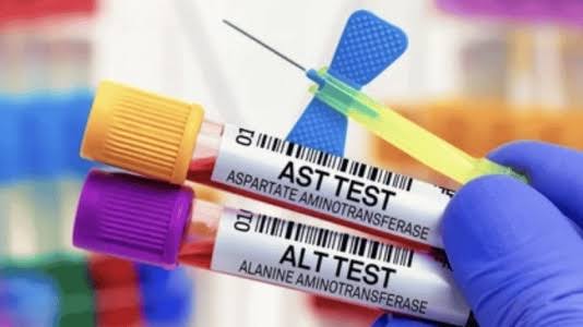 alt-and-ast-blood-tests-what-they-mean-body — AST ALT ratio diagnostic significance liver disease causes