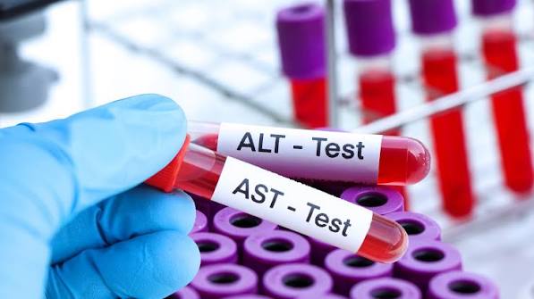 ALT and AST blood tests what they mean — liver enzyme interpretation elevated ALT AST causes