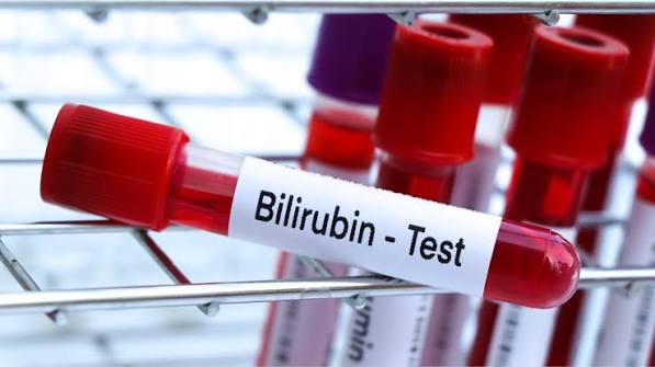 bilirubin-test-what-adults-should-know-body — jaundice causes diagnosis cholestasis haemolysis liver disease