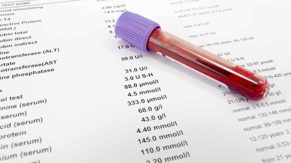 bilirubin test what adults should know — total direct indirect bilirubin jaundice liver bile duct