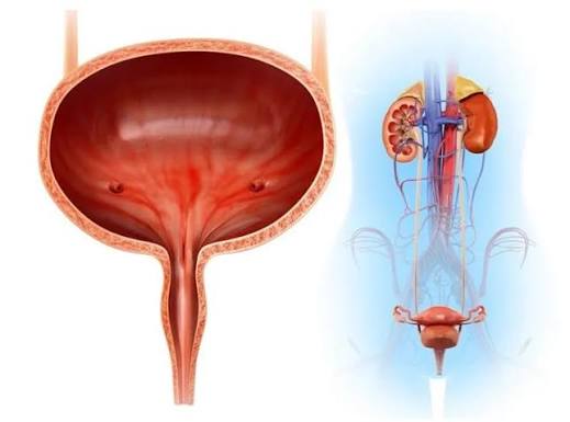 bladder pain possible causes — anatomical diagram showing the bladder and surrounding pelvic structures with annotations indicating the locations and types of pain from UTI, interstitial cystitis, bladder stones, and other causes