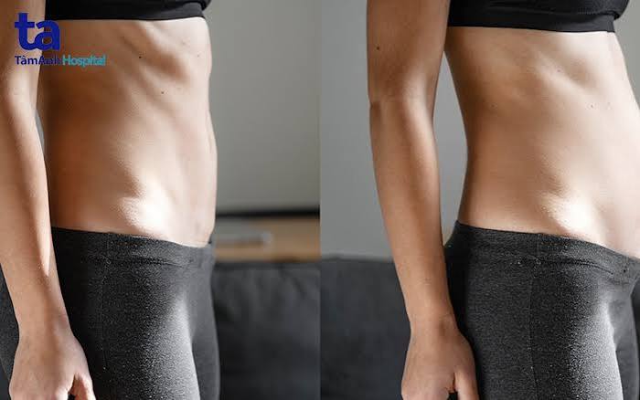 bloating-common-causes-and-when-to-seek-care-body — dietary and medical causes of bloating in adults