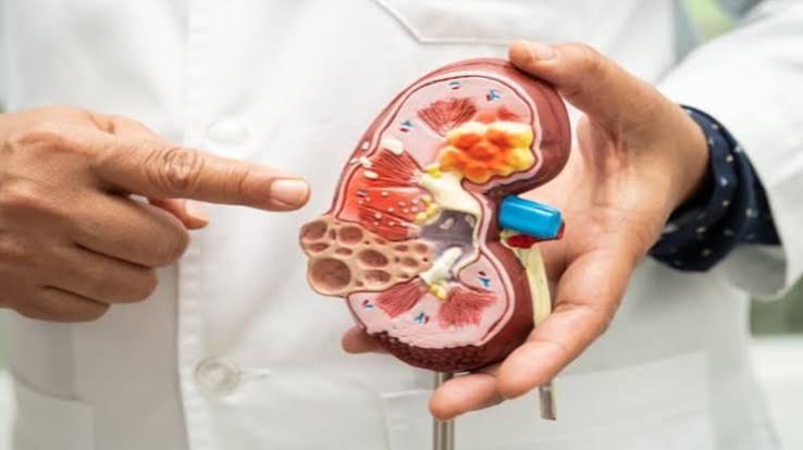 blood pressure log for kidney health — completed CKD blood pressure log showing morning and evening readings with medication and lifestyle context columns